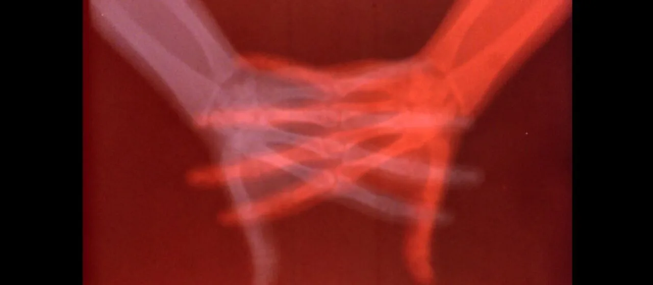 Overexposed: Art, Technology, and the Body